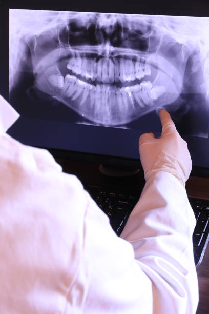 Best Emergency Treatment for Dental Infections or Abscesses in Exmore, VA